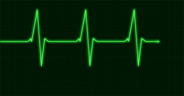 Nguyên nhân và cách phòng ngừa phiếu điện tim hiệu quả