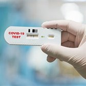Vì sao test nhanh Covid âm tính, vẫn không được chủ quan?