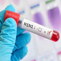 H1N1 là gì? Cúm A H1N1 là gì?